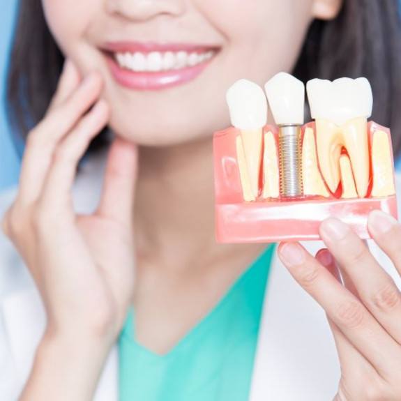 A dentist holding a plastic replica of a dental implant